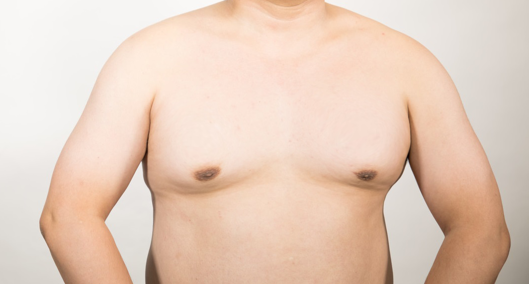 男性女乳