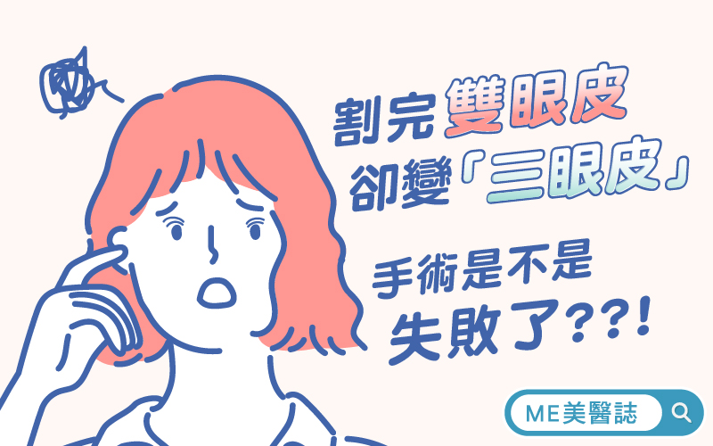 三眼皮