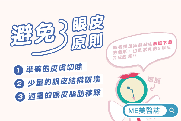 三眼皮怎麼辦